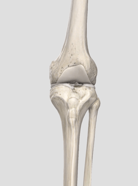 usure du cartilage