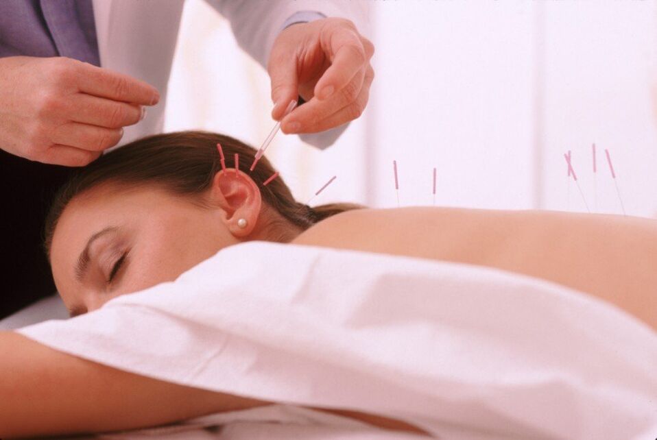 Acupuncture et acupuncture avec ostéochondose cervicale