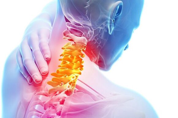 Les causes de l'ostéochondose cervicale